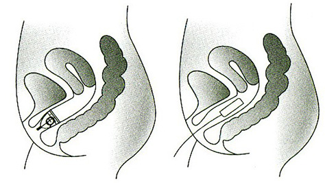 anatomický obrázek