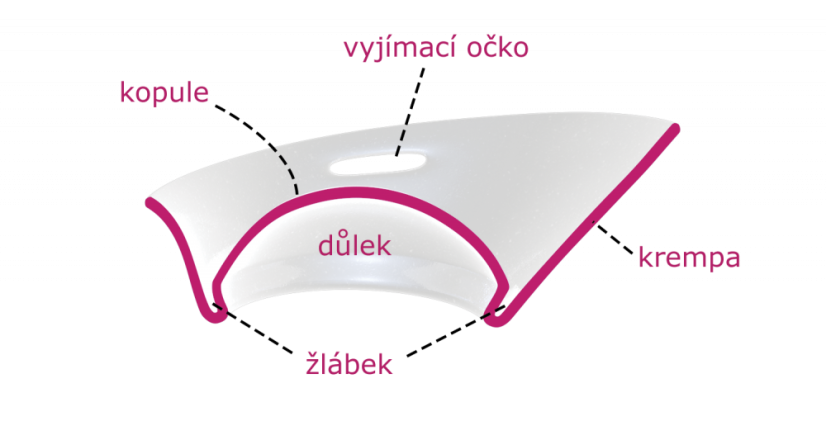Evanella – cervikální klobouček, měkčí varianta (ametystová)